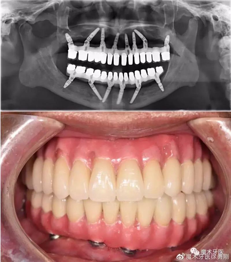 4_副本.jpg 4_副本.jpg