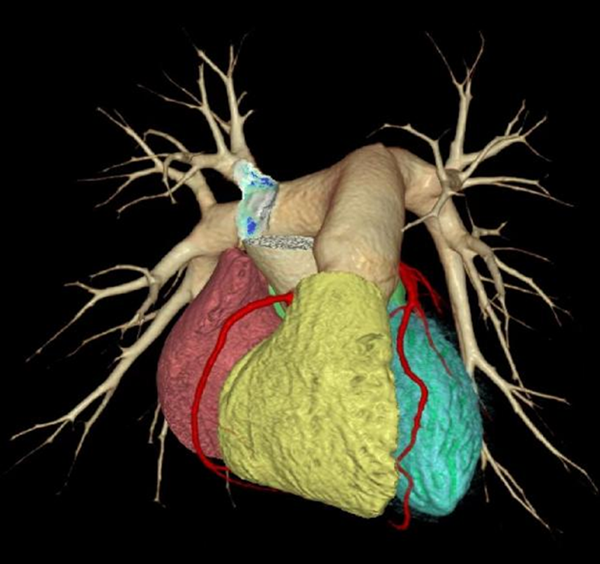 45487365.png 45487365.png