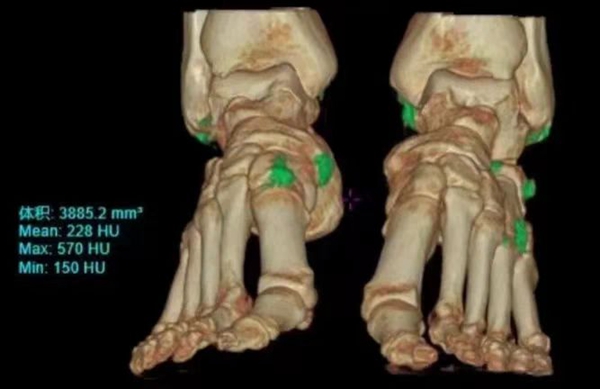 019d5a13b207d4752d6ef2b9173d413.jpg 019d5a13b207d4752d6ef2b9173d413.jpg