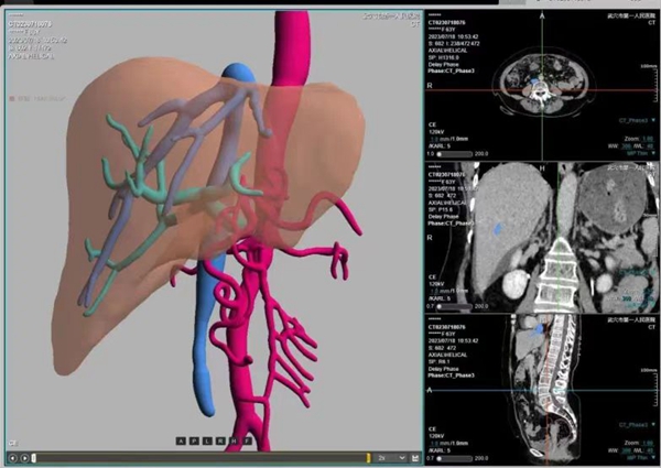 53f543ea7f0b99203ff9586b1214462.jpg 53f543ea7f0b99203ff9586b1214462.jpg