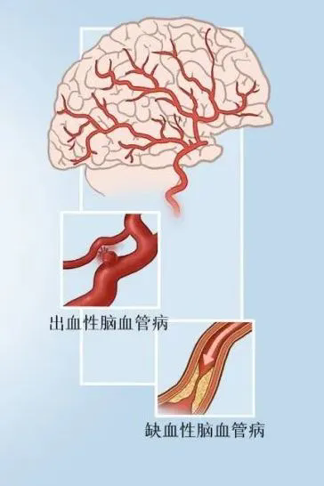 640_wx_fmt=jpeg&from=appmsg&tp=webp&wxfrom=5&wx_lazy=1&wx_co=1.webp (3).png