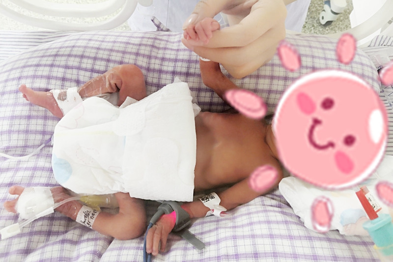 0607 新生儿科 早产儿6_副本.jpg