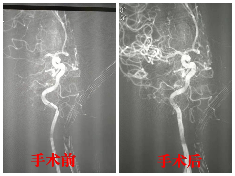 手术前后.jpg 手术前后.jpg