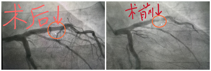 术前术后.jpg 术前术后.jpg