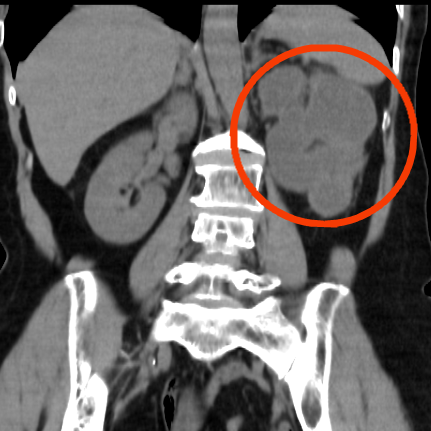 肾_副本.png 肾_副本.png