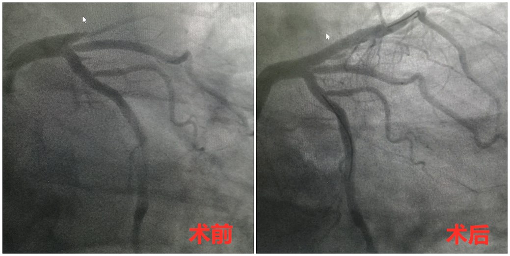 71da3bae5e2e4c5fbbaf2120c743cf3_副本.jpg 71da3bae5e2e4c5fbbaf2120c743cf3_副本.jpg