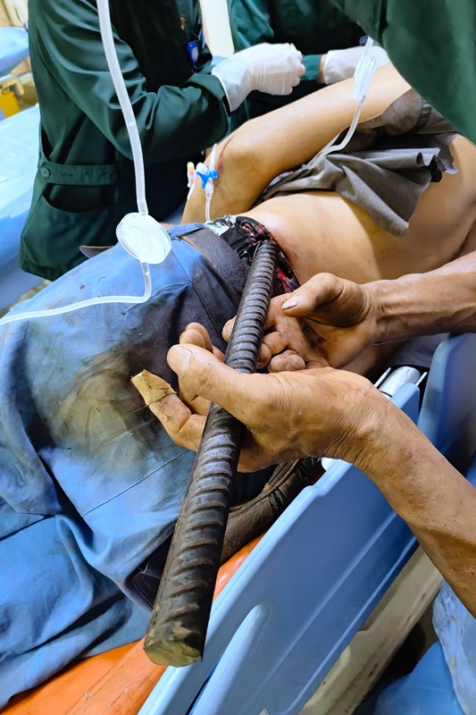 0901 钢筋穿刺13.jpg