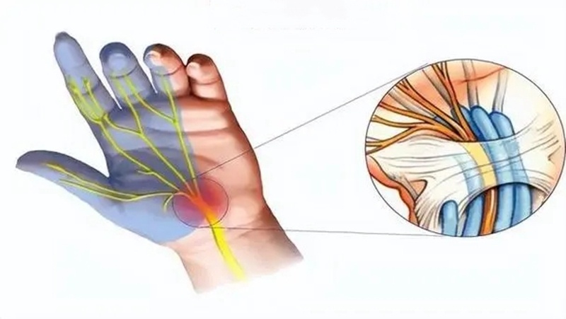5e1b9d9569e0448bb27fc8016afa3da0.jpg 5e1b9d9569e0448bb27fc8016afa3da0.jpg