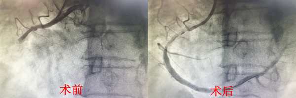 640.webp (4)_副本.png 640.webp (4)_副本.png