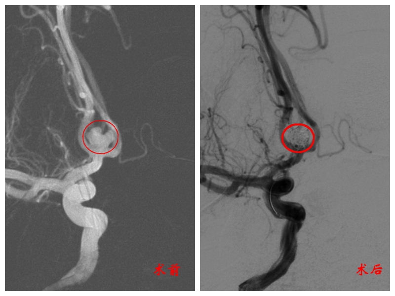 造影.jpg 造影.jpg