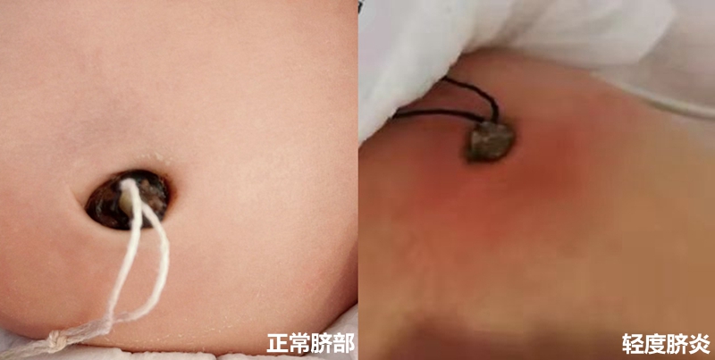 NeoImage_副本.jpg NeoImage_副本.jpg